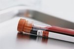 Определить наличие депрессии скоро можно будет самостоятельно