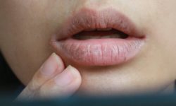 10 домашних способов избавиться от сухости во рту