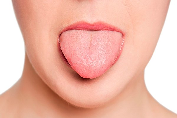 Как предотвратить сухость во рту?