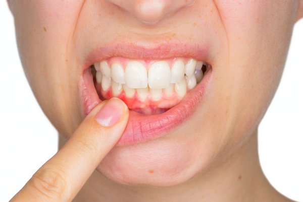Здоровье полости рта
